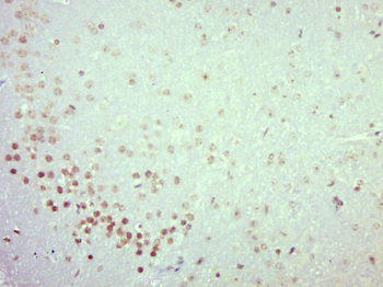 CASC3 Rabbit Polyclonal Antibody