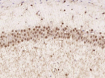 Phospho-AMPK alpha-1 (Thr183) Rabbit Polyclonal Antibody