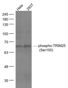 Phospho-TRIM25 (Ser100) Rabbit Polyclonal Antibody