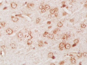 SYT6 Rabbit Polyclonal Antibody