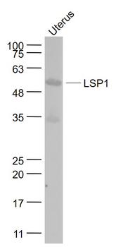 LSP1 Rabbit Polyclonal Antibody