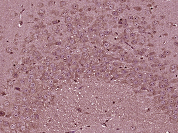 TNIK Rabbit Polyclonal Antibody