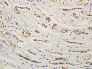 YES1 Rabbit Polyclonal Antibody