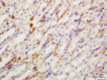 YES1 Rabbit Polyclonal Antibody