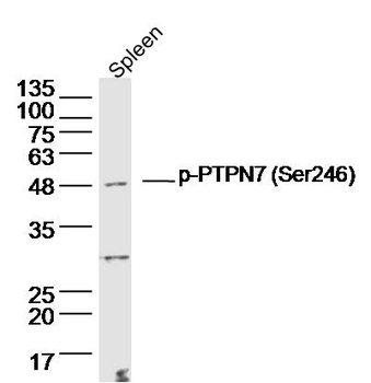 Phospho-PTPN7 (Ser246) Rabbit Polyclonal Antibody