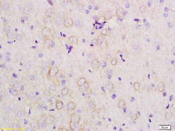 Apolipoprotein E3 Rabbit Polyclonal Antibody