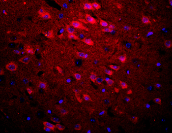 Apolipoprotein E3 Rabbit Polyclonal Antibody