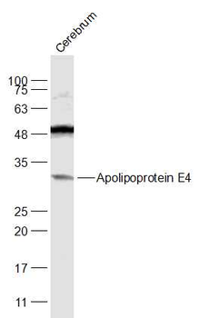 Apolipoprotein E4 Rabbit Polyclonal Antibody
