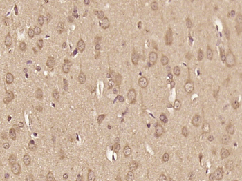 Phospho-Amyloid Precursor Protein (Ser730) Rabbit Polyclonal Antibody