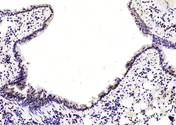 CUEDC2 Rabbit Polyclonal Antibody