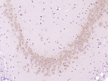 VAPB Rabbit Polyclonal Antibody