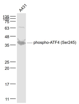 Phospho-ATF4 (Ser245) Rabbit Polyclonal Antibody