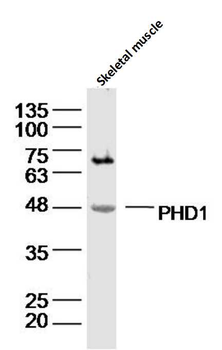PHD1 Rabbit Polyclonal Antibody