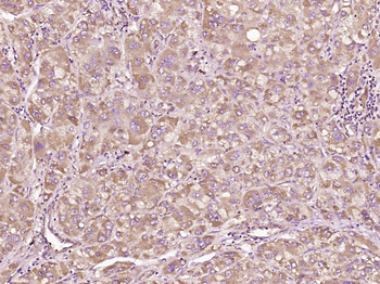 Bax Rabbit Polyclonal Antibody