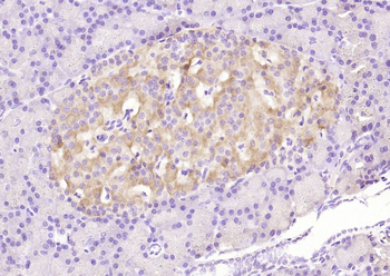 Phospho-Bax (Ser184) Rabbit Polyclonal Antibody