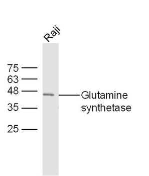 Glutamine synthetase Rabbit Polyclonal Antibody