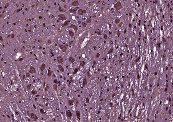 Phospho-Bcl-2 (Thr129) Rabbit Polyclonal Antibody