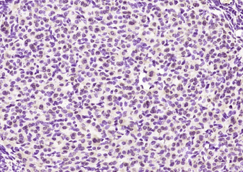 Phospho-Bcl-2 (Thr129) Rabbit Polyclonal Antibody
