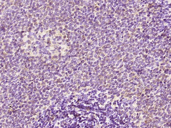 Phospho-Bcl-2 (Thr129) Rabbit Polyclonal Antibody