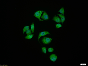 Phospho-Smad3 (Ser204) Rabbit Polyclonal Antibody