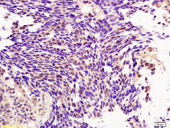 PCGF4/BMI1 Rabbit Polyclonal Antibody