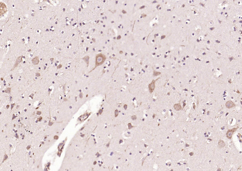 BLNK Rabbit Polyclonal Antibody