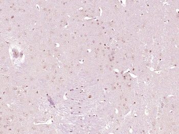BMPR2 Rabbit Polyclonal Antibody