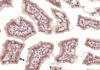 Phospho-RPA2 (Thr21) Rabbit Polyclonal Antibody