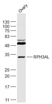 RPH3AL Rabbit Polyclonal Antibody