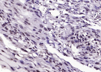 Phospho-B-Raf (Ser602) Rabbit Polyclonal Antibody