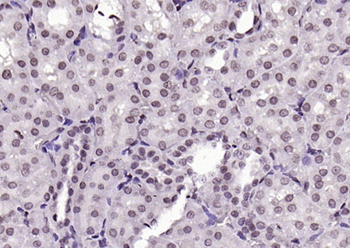 Phospho-B-Raf (Ser602) Rabbit Polyclonal Antibody