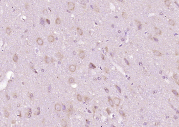 Phospho-BRAF (Thr597) Rabbit Polyclonal Antibody