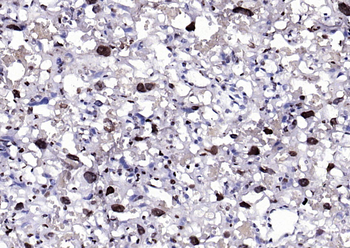 Phospho-BRAF (Thr401) Rabbit Polyclonal Antibody