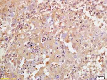 Phospho-BRCA1 (Ser1189) Rabbit Polyclonal Antibody
