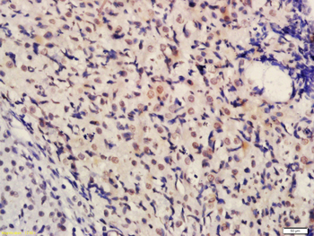 Phospho-BRCA1 (Ser1189) Rabbit Polyclonal Antibody