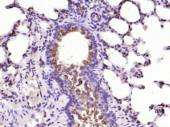 MUC1 Rabbit Polyclonal Antibody