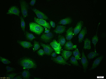 MUC1 Rabbit Polyclonal Antibody