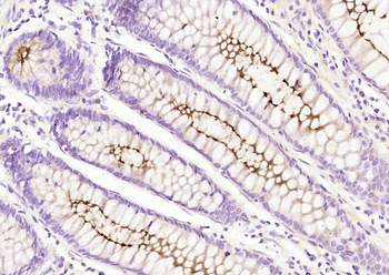 MUC1 Rabbit Polyclonal Antibody
