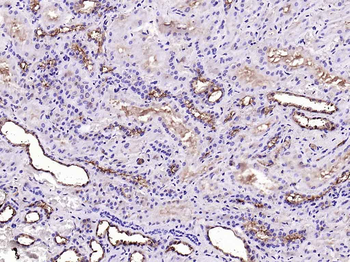 MUC1 Rabbit Polyclonal Antibody