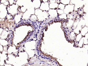MUC1 Rabbit Polyclonal Antibody