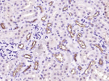 MUC1 Rabbit Polyclonal Antibody