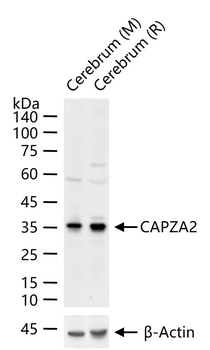 CAPZA2 Rabbit Polyclonal Antibody
