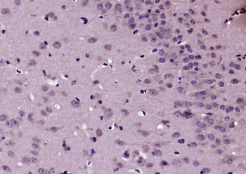 TRAK1 Rabbit Polyclonal Antibody