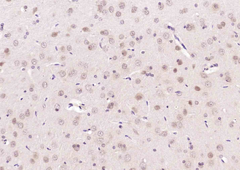 MAPK11 Rabbit Polyclonal Antibody