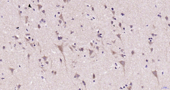 MAPK11 Rabbit Polyclonal Antibody