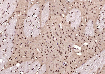 Phospho-NDEL1 (Thr219) Rabbit Polyclonal Antibody