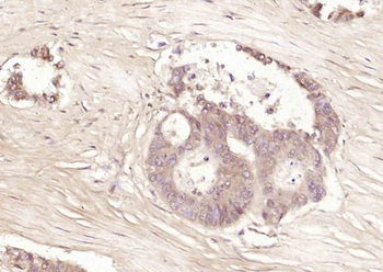 Selenium Binding Protein 1 Rabbit Polyclonal Antibody