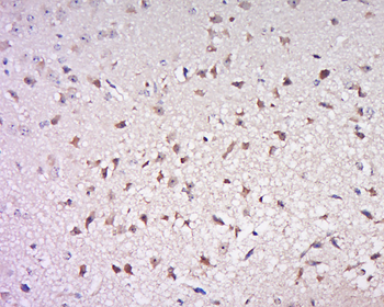 Phospho-Cdc25B (Ser186) Rabbit Polyclonal Antibody