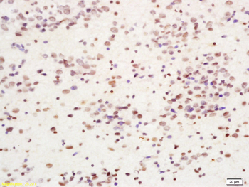Cdc7 Rabbit Polyclonal Antibody