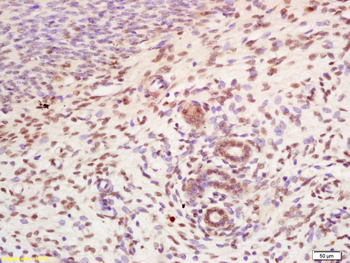 CDCA4 Rabbit Polyclonal Antibody